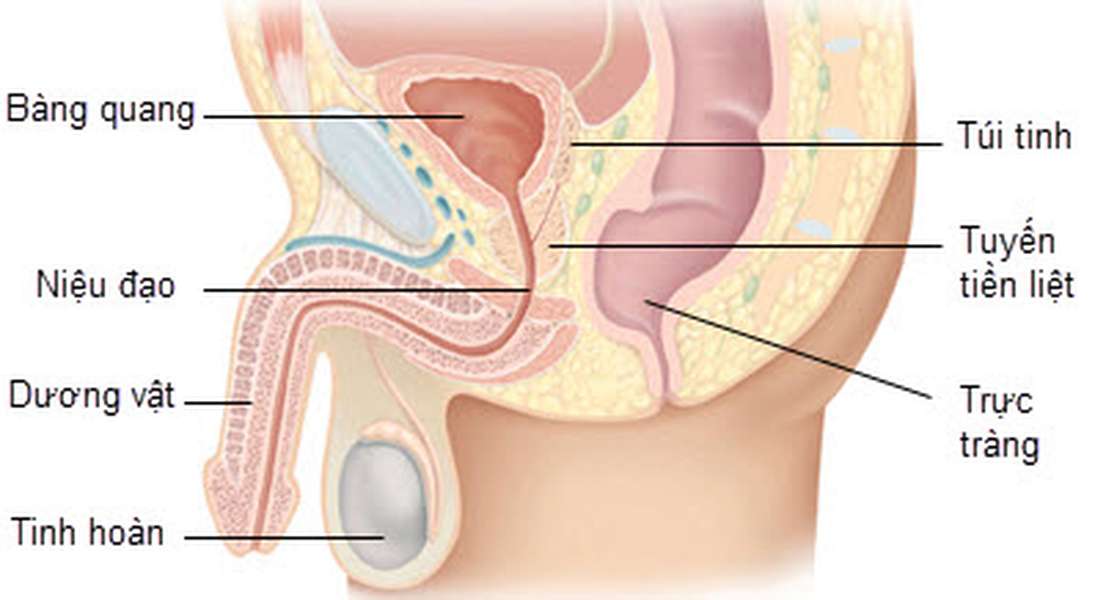 Ảnh 1 của Inflammatory disease of prostate